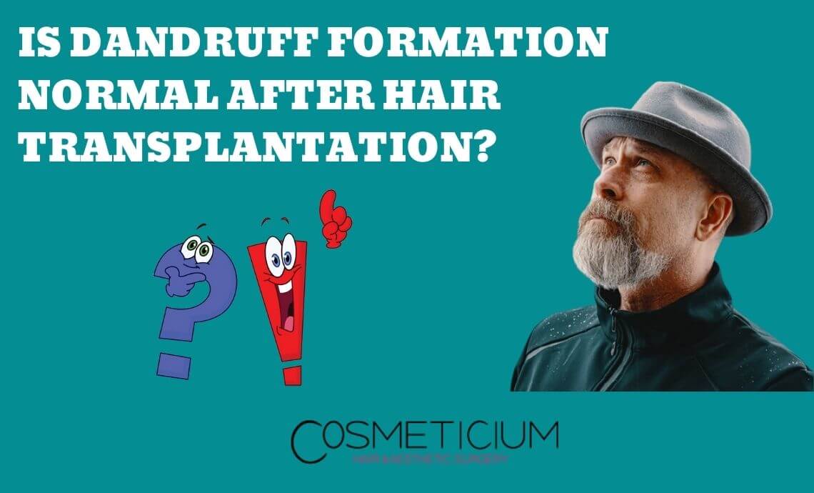Is Dandruff Formation Normal After Hair Transplantation?