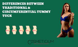 Standard and Circumferential Tummy Tuck