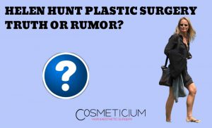 Helen Hunt Plastic Surgery
