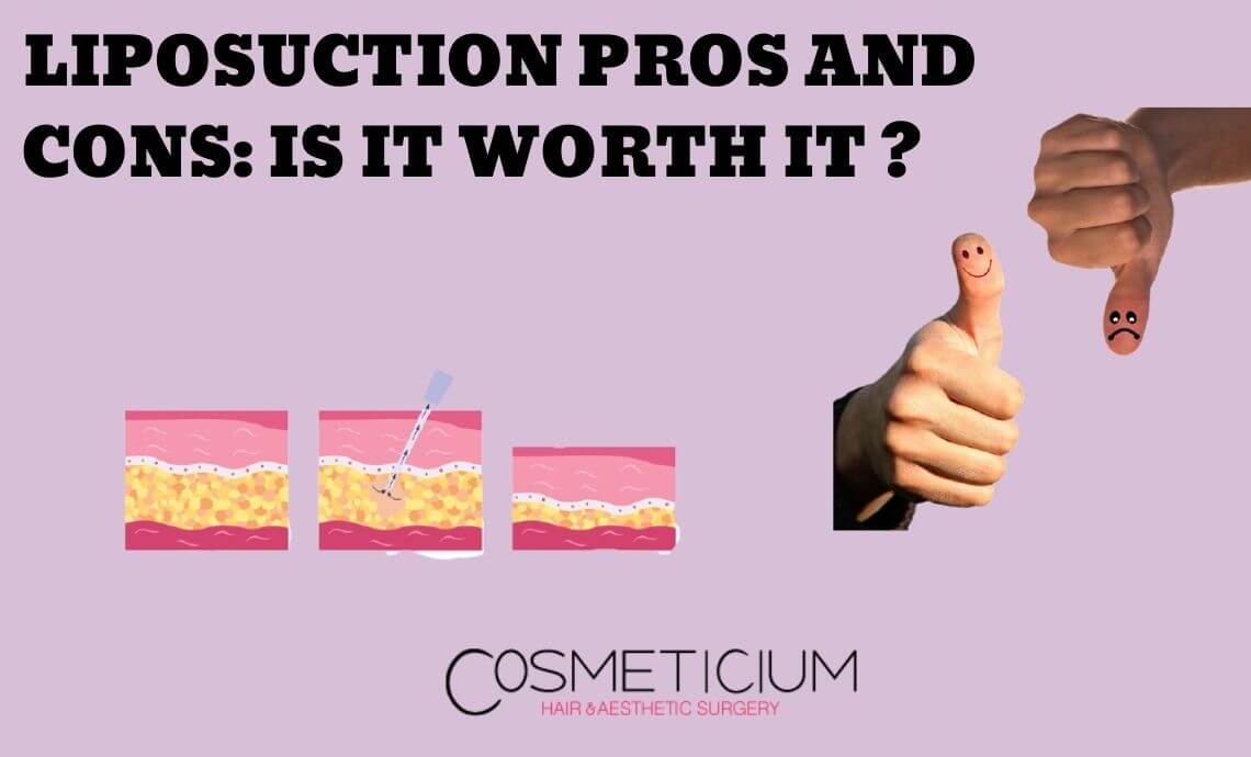 Liposuction Pros and Cons: Is It Worth It?