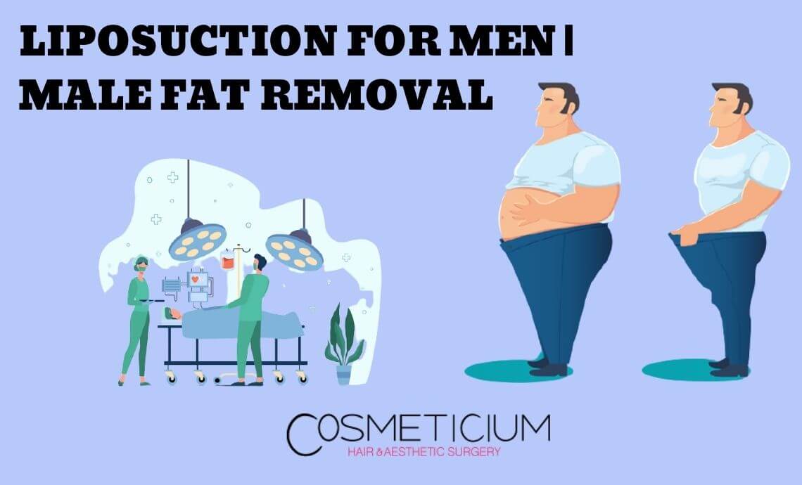 Liposuction for Men | Male Fat Removal Surgery in Turkey
