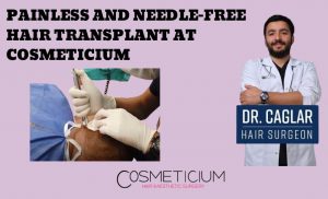 Needle-Free Hair Transplant