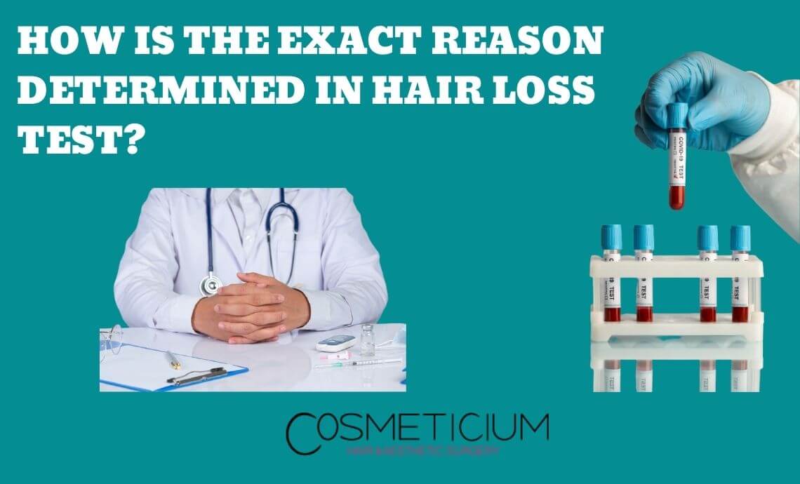 How is the Exact Reason Determined in Hair Loss Test?