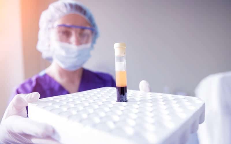 PRP (Platelet Rich Plasma) Procedure