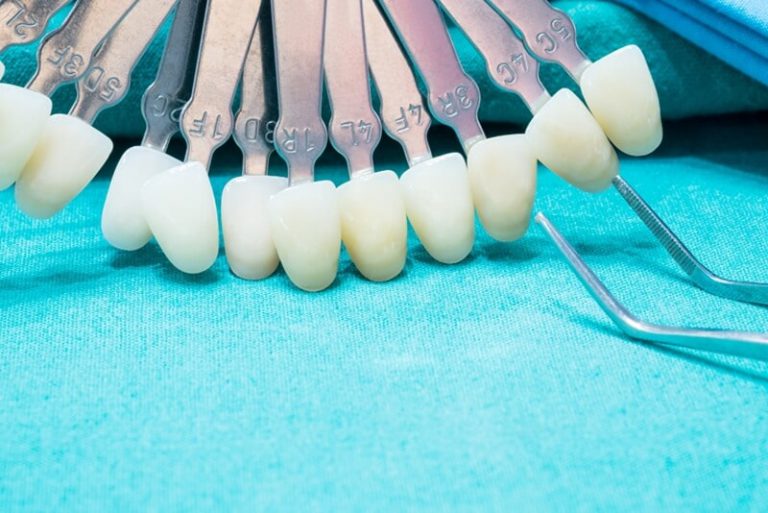 Do Porcelain Veneers Stain? Cosmeticium