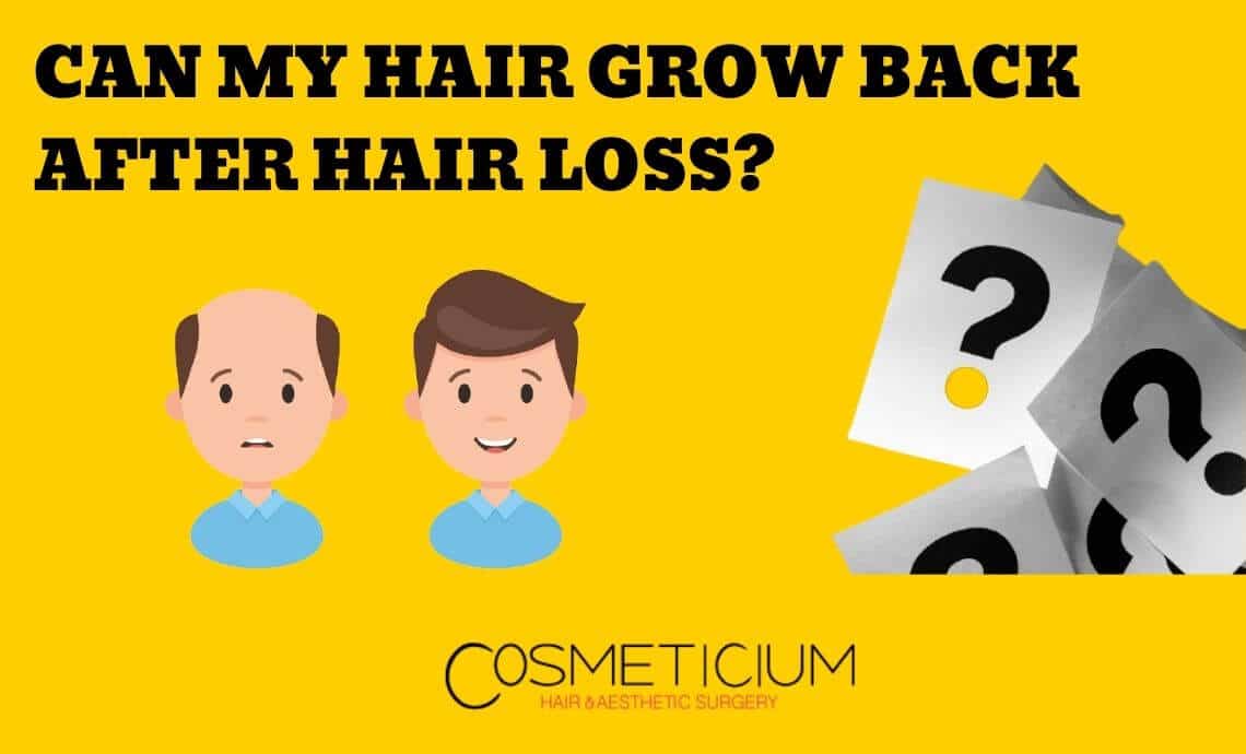 Can My Hair Grow Back After Hair Loss?