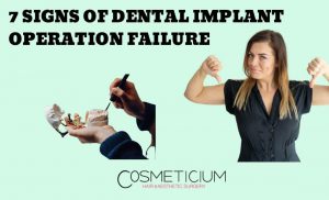 Dental Implant Failure