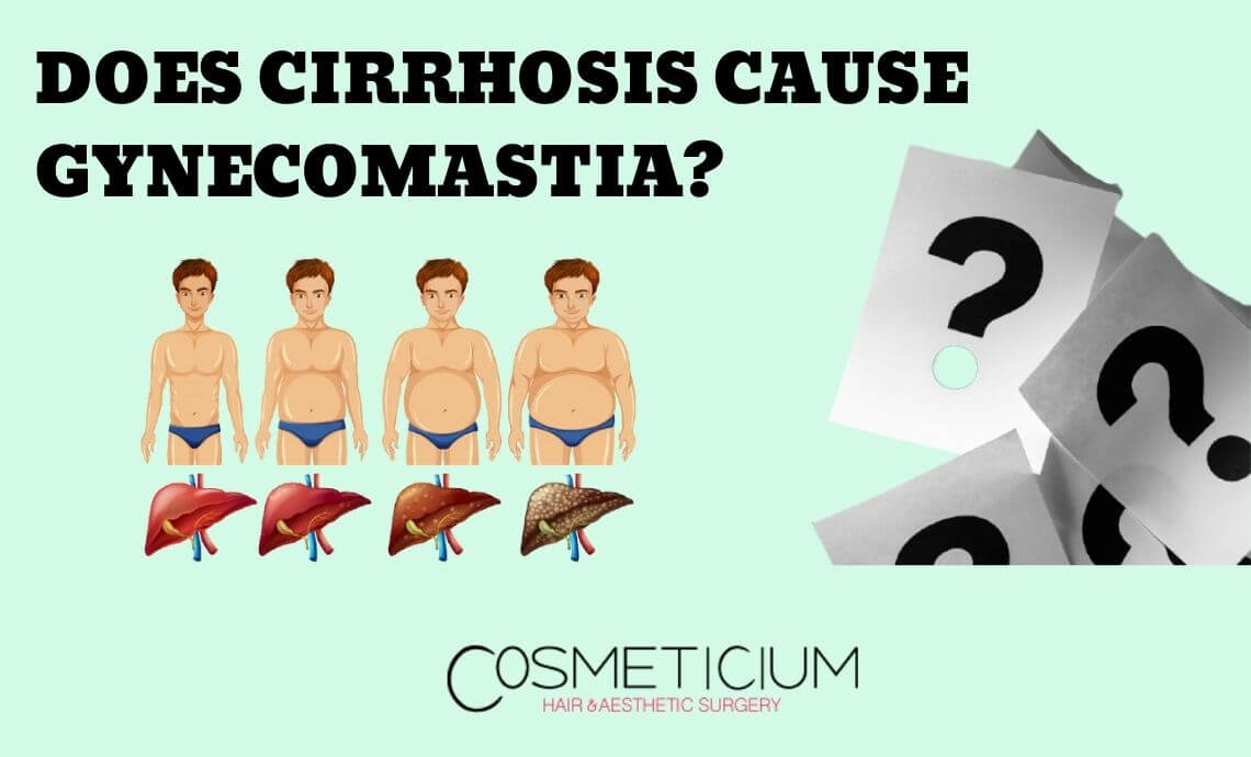 Does Cirrhosis Cause Gynecomastia?