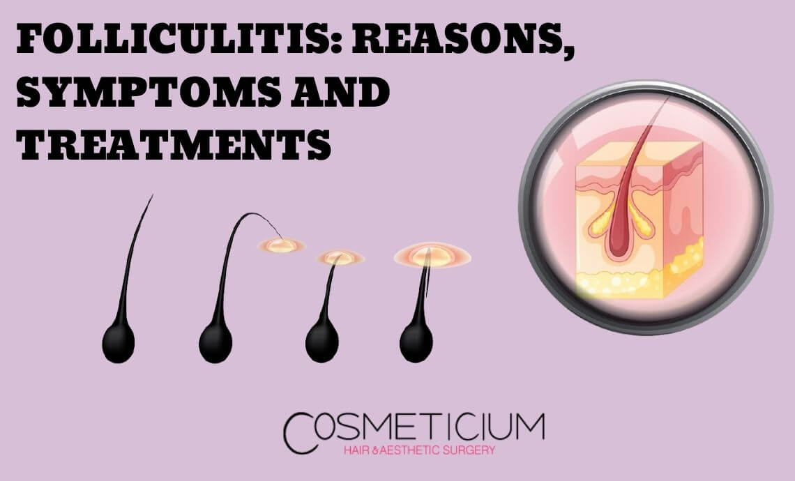 Folliculitis (Hair Follicle Inflammation): Reasons, Symptoms and Treatments