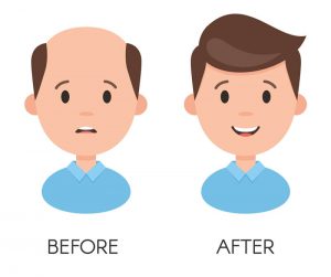 Grow Hair Again