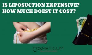 How Much Does Liposuction Cost?