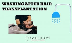 Washing After Hair Transplantation