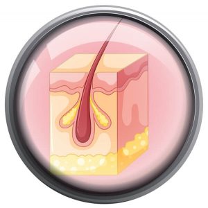Folliculitis Symptoms
