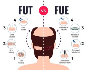 FUT & FUE