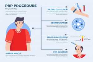 PRP for Hair Intensity