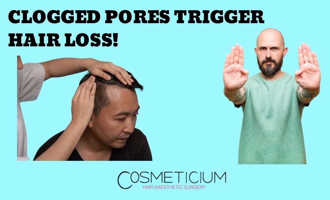 Clogged Pores Trigger Hair Loss!