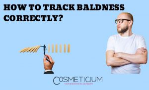 Track Baldness