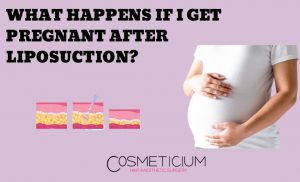 Pregnant After Liposuction