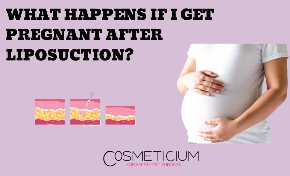 What Happens If I Get Pregnant After Liposuction?