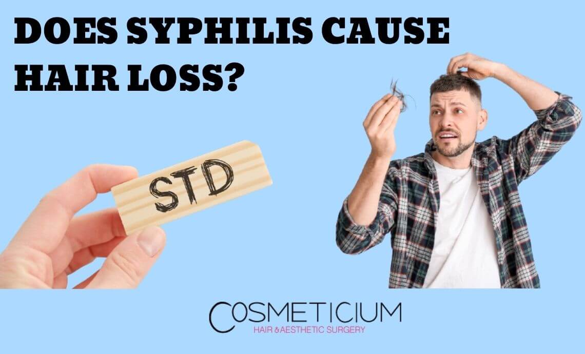 Syphilis Hair Loss