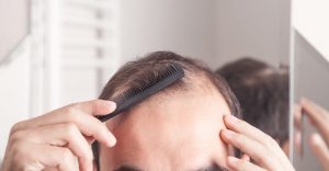 I Can See My Scalp Through My Hair