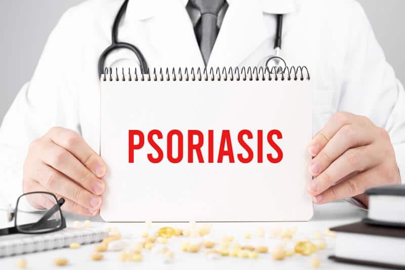 Scalp Psoriasis Hair Loss