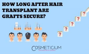 How Many Days After Hair Transplant Are Grafts Secure?