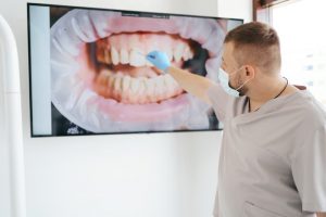 What Causes Crooked Teeth?