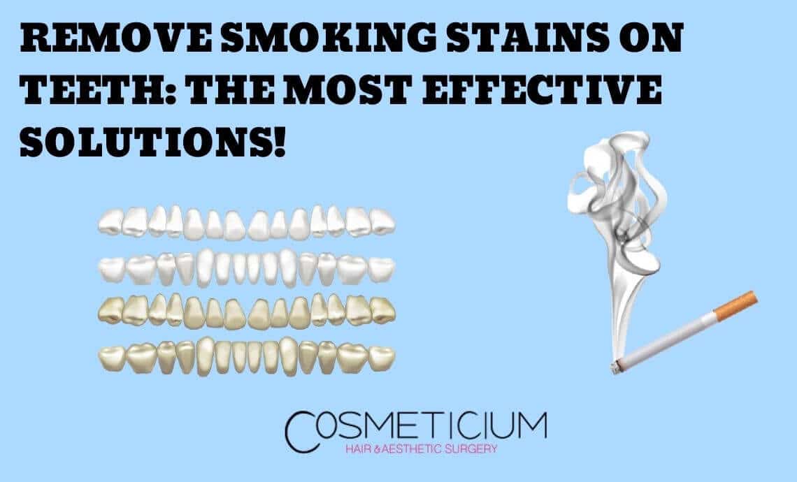 Remove Smoking Stains on Teeth: The Most Effective Solutions!