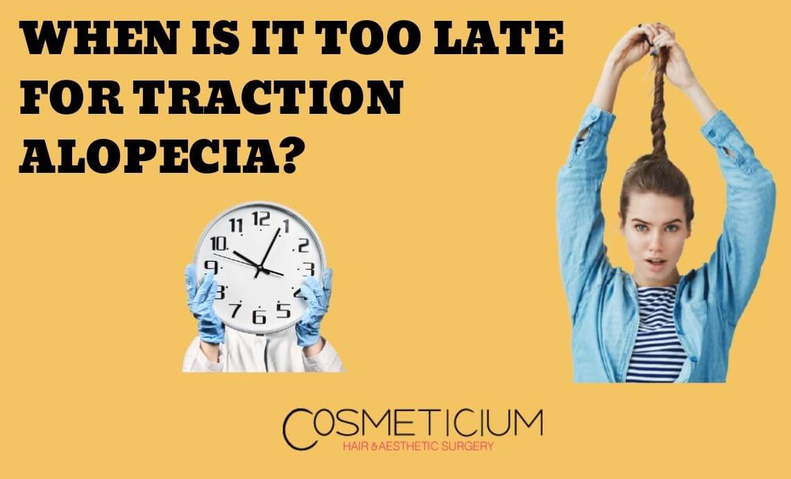 When Is It Too Late for Traction Alopecia? – Find Where to Look!