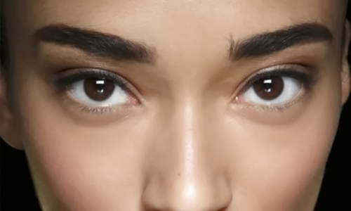 Eyebrow Transplantation