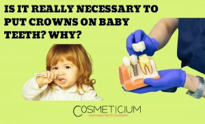 Crowns on Baby Teeth