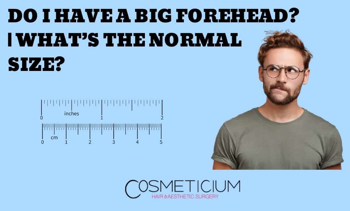 Do I Have A Big Forehead? | What’s the Normal Size?