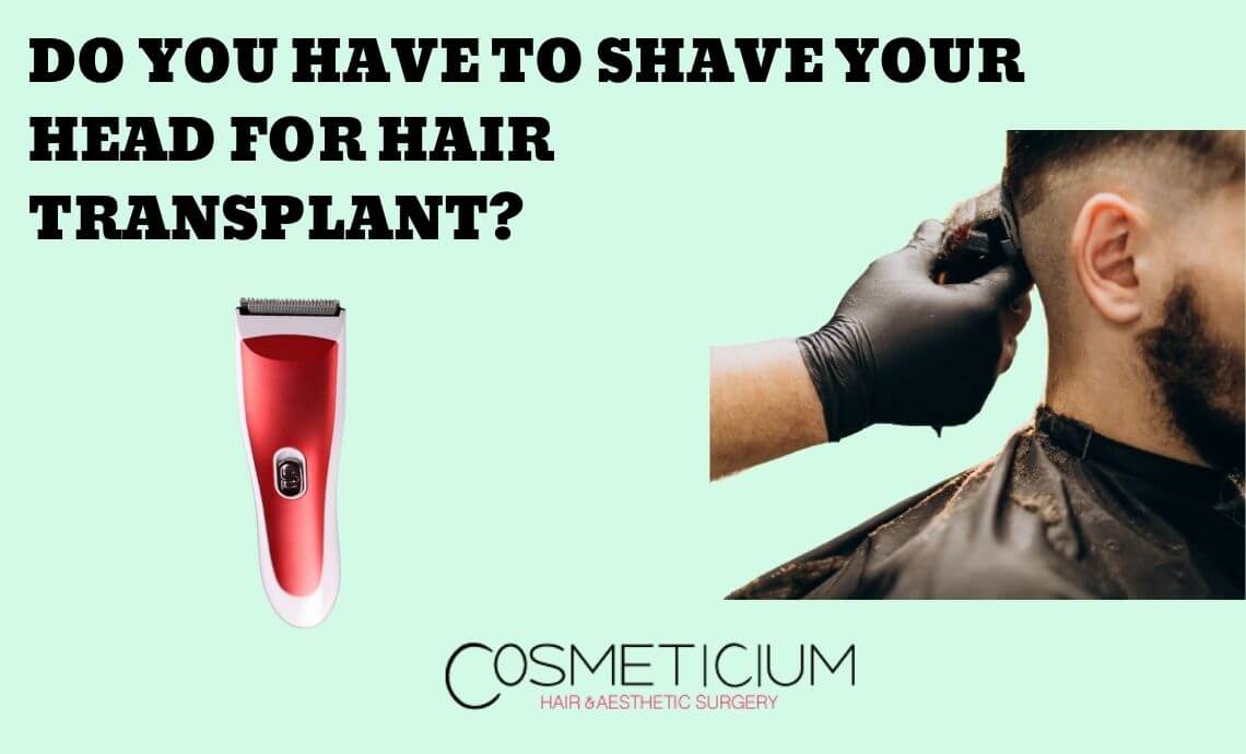 Do You Have to Shave Your Head for Hair Transplant?