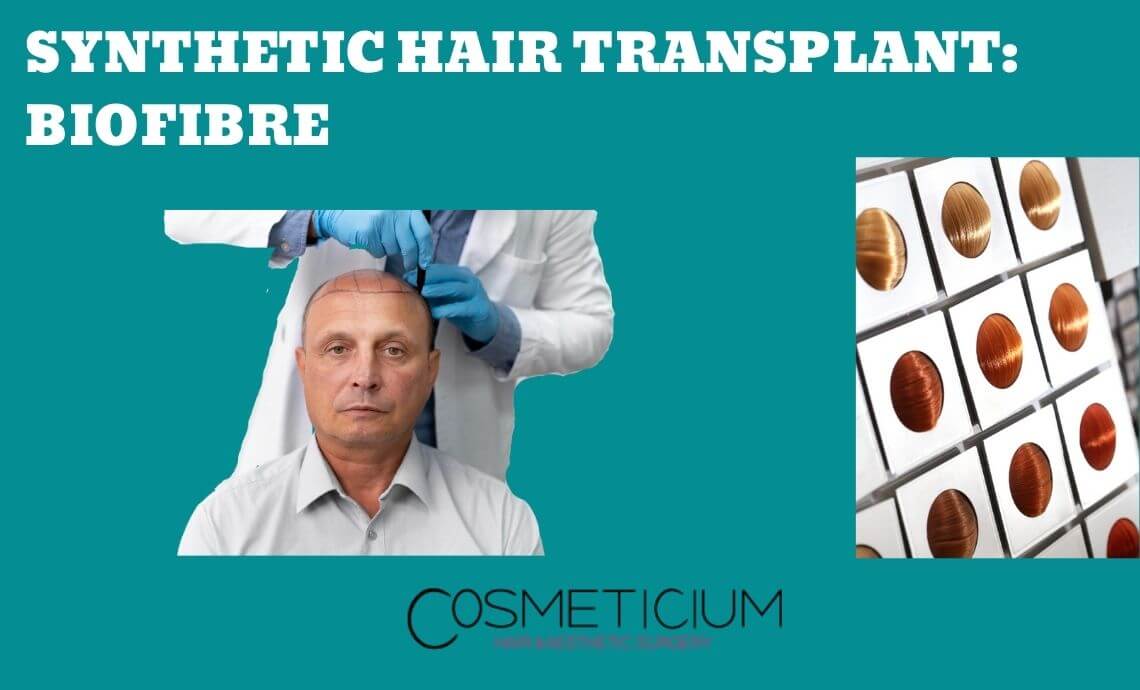 Synthetic Hair Transplant (Biofibre): Read This Before You Decide!
