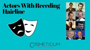 32 Actors With Receding Hairline