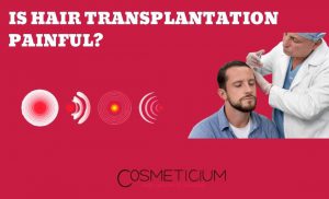 How Painful is a Hair Transplantation?