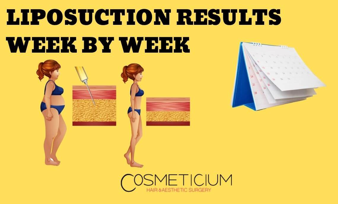 Liposuction Results Week by Week from Disaster to Miracle