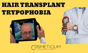 FUE Hair Transplant Trypophobia