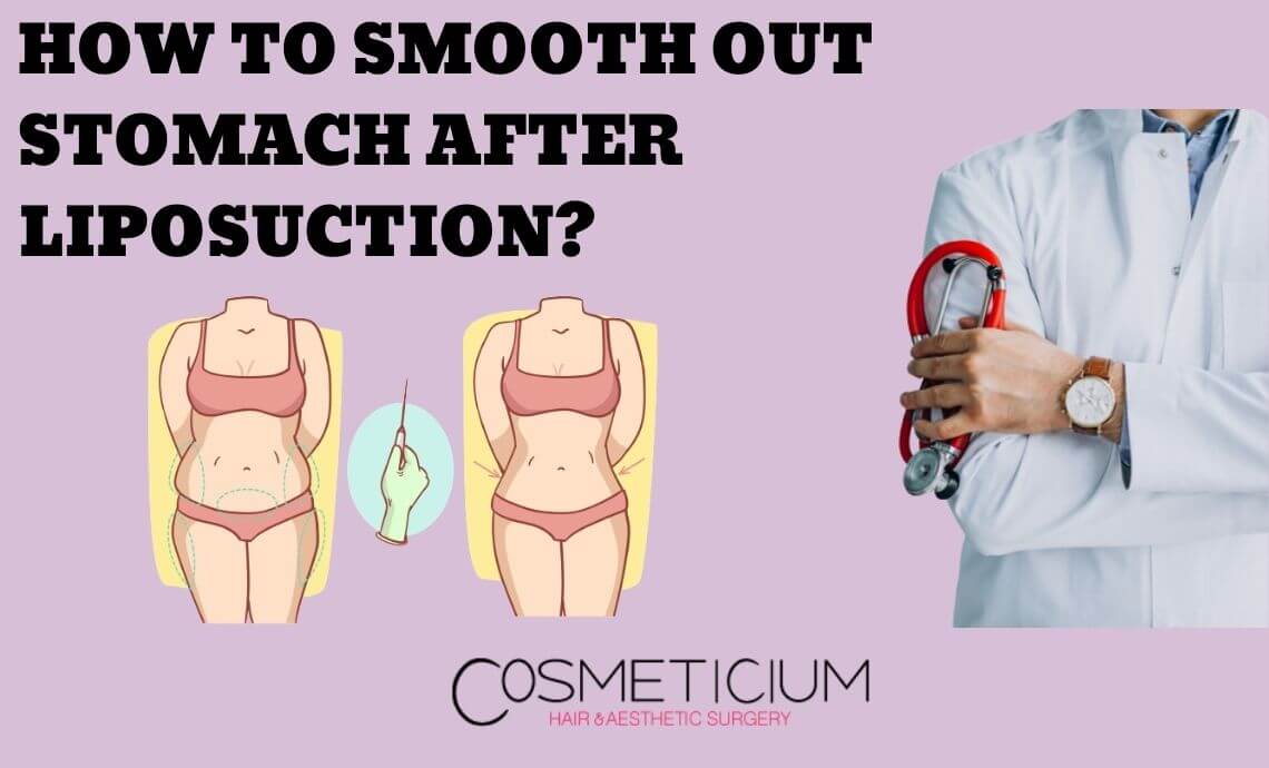 How to Smooth Out Stomach after Liposuction?