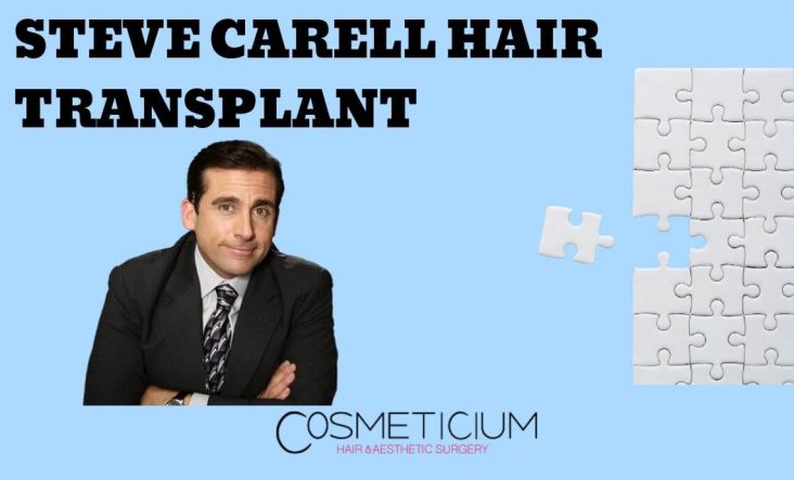 Did Steve Carell Get Hair Transplant?