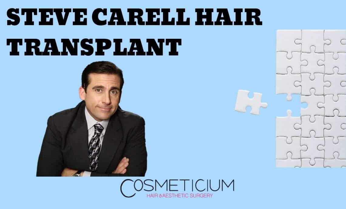 Steve Carell Hair Transplant | What Does He Look Like Now?