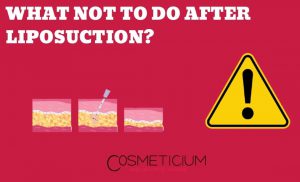 Bad Habits After Liposuction
