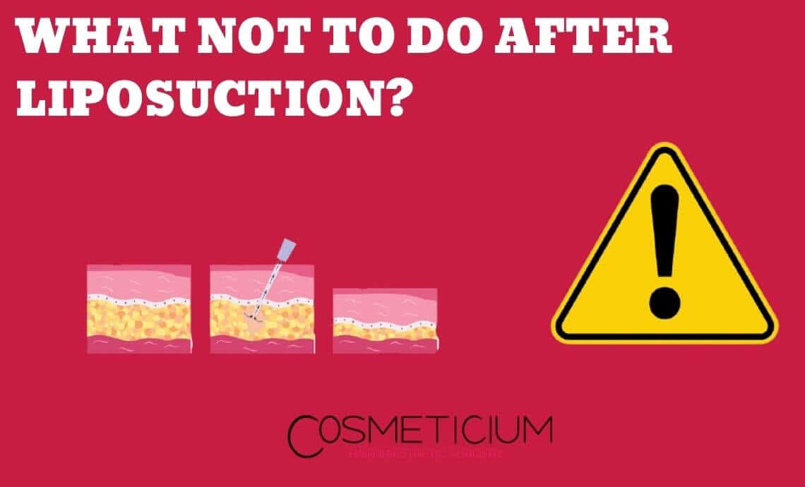 What Not To Do After Liposuction? Improve Your Lipo Result!