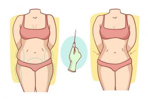 How to Smooth Out Stomach after Liposuction?
