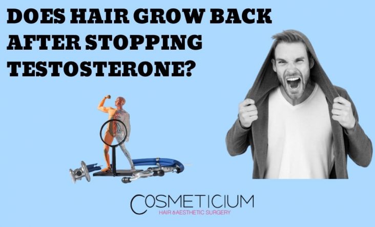 The Relationship of Testosterone with Hair Loss