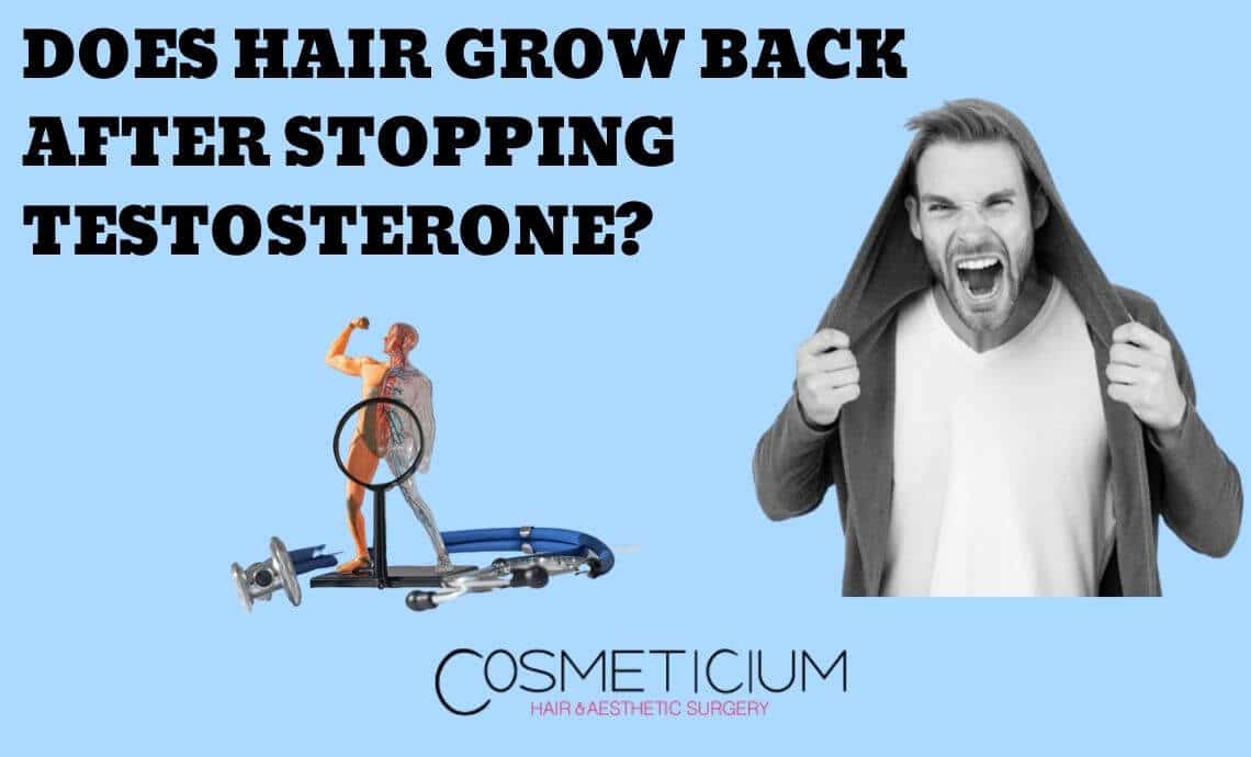 Does Hair Grow Back after Stopping Testosterone?