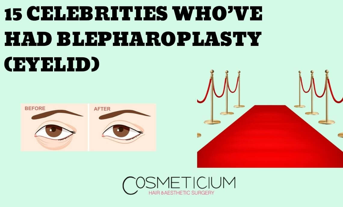 15 Celebrities Who Have Had Blepharoplasty (Eyelid Surgery)