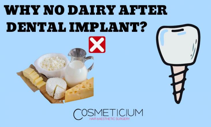 Why No Dairy After Dental Implant? Here’s what to Eat or Not?