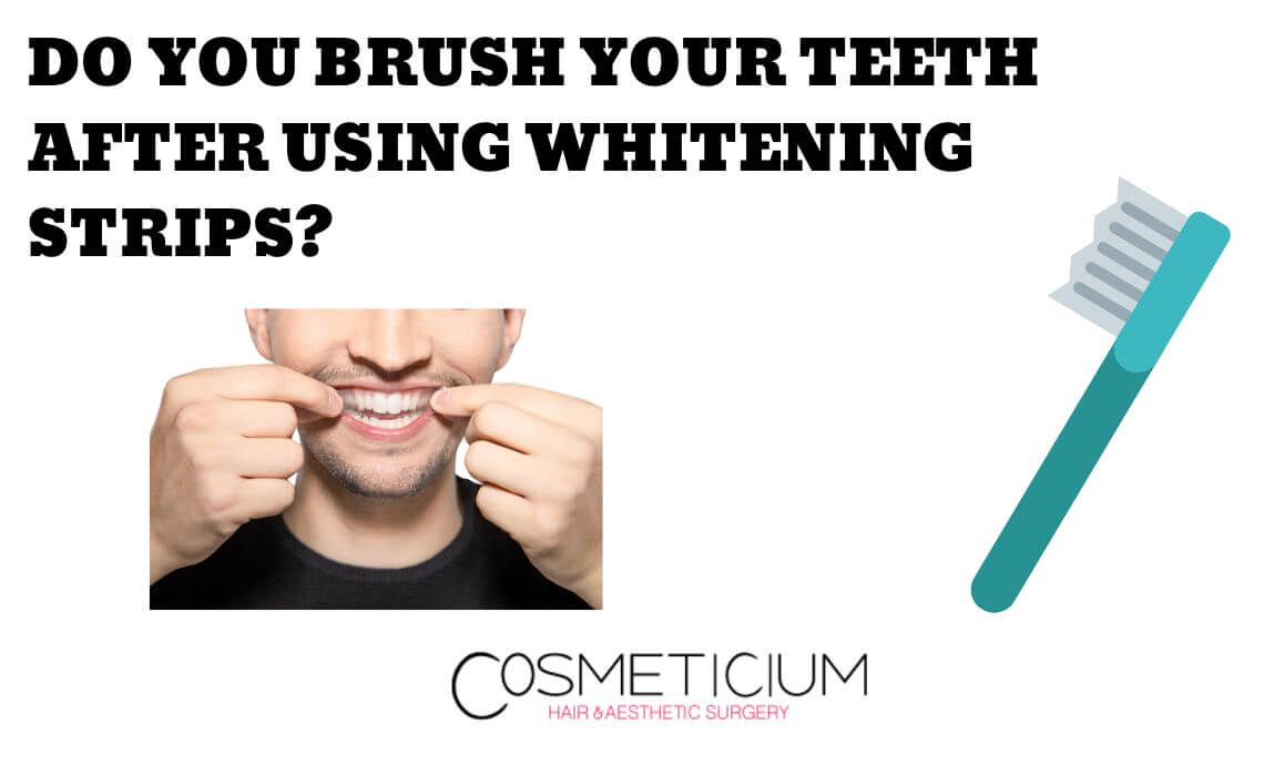 Do You Brush Your Teeth After Using Whitening Strips?